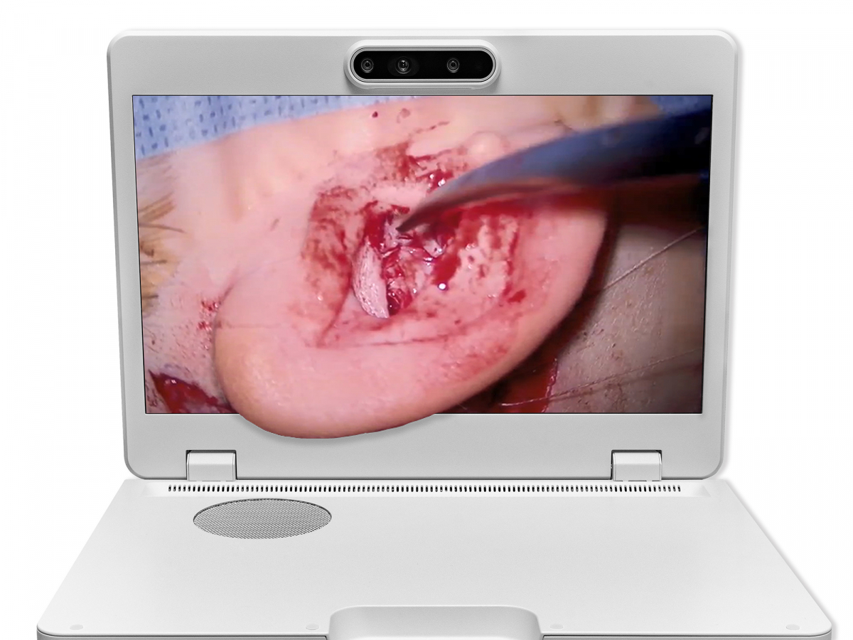 达擎之＂Heads-up 3D显微手术显示系统＂，整合4K裸眼3D显示及眼球追踪系统，具备快速追踪人眼移动位置功能，减轻医师长时间维持固定姿势的负担，让医师能有更宽广清晰的3D立体视野及更舒适的姿势来执行手术。